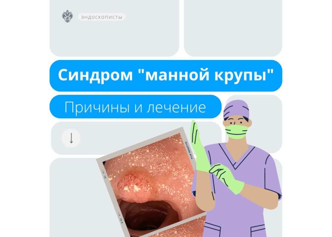 Синдром манной крупы: как его распознать и лечить